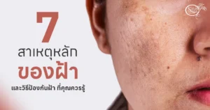 7 สาเหตุหลักของฝ้า ที่คุณควรรู้
