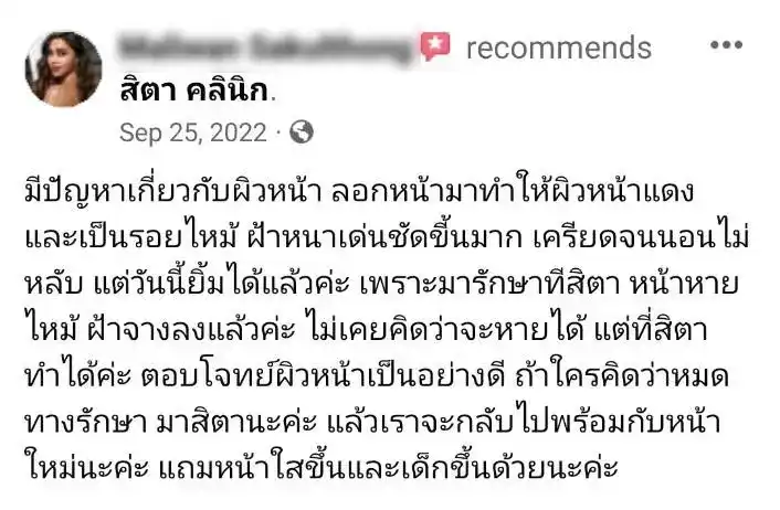 รีวิว รักษาฝ้า สิตา คลินิก