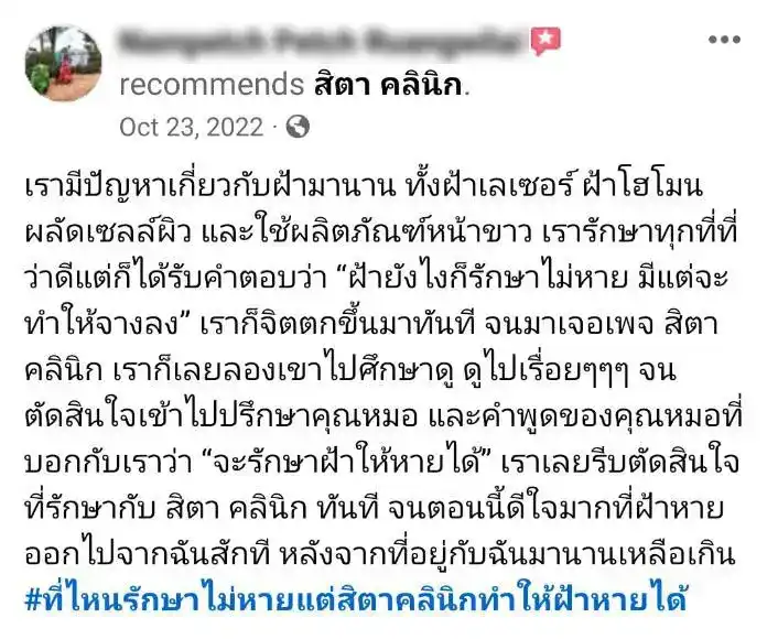 รีวิว รักษาฝ้า สิตา คลินิก