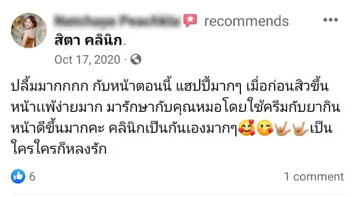 รีวิว รักษาฝ้า สิตา คลินิก