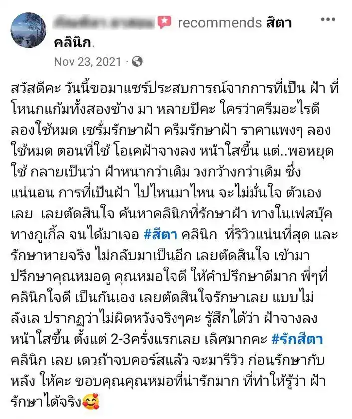 รีวิว รักษาฝ้า สิตา คลินิก