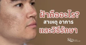 ฝ้าคืออะไร สาเหตุ อาการ และวิธีรักษาฝ้า